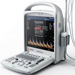 2D color doppler Ultrasound System ZUS-A30