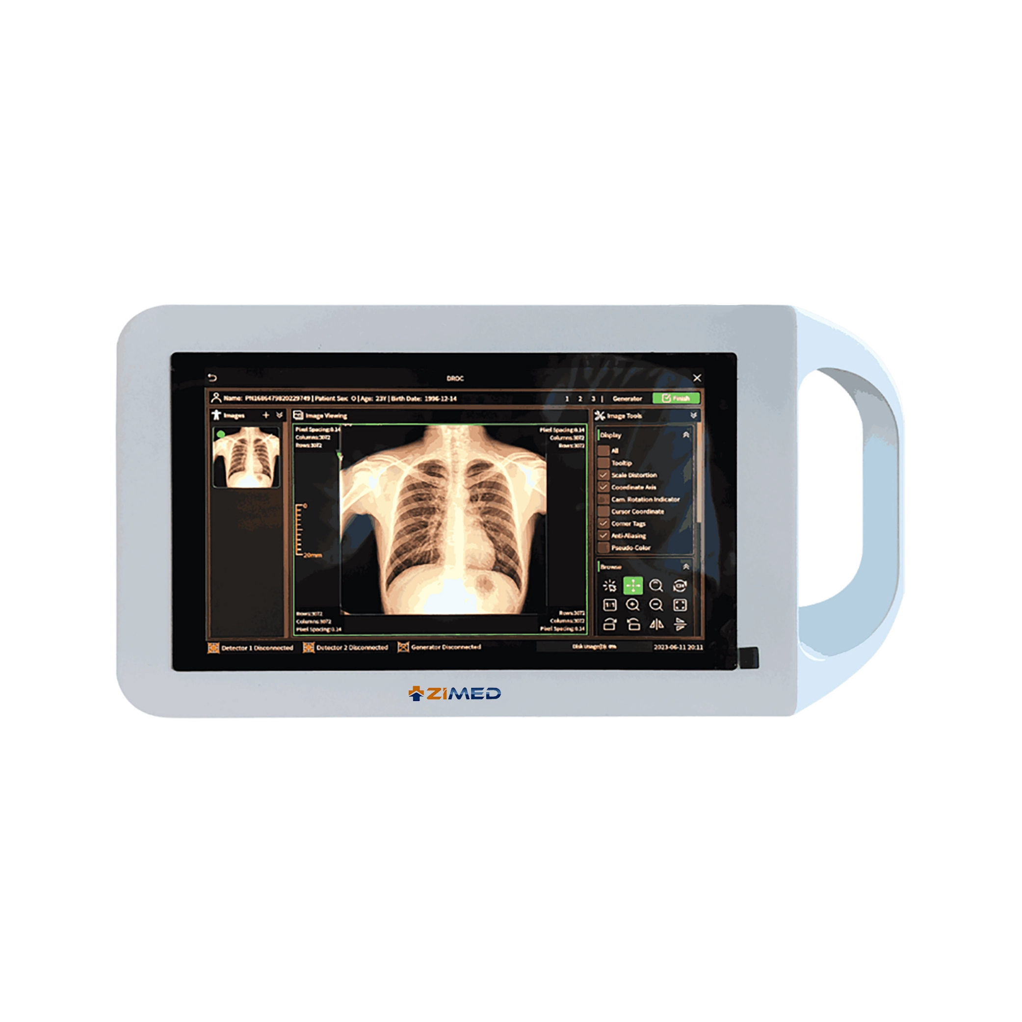 Digital Portable X-Ray ZPXR-A12